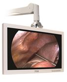 26" FSN Medical Enhanced LCD Display Monitor