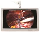 26" FSN Medical Expanded LCD Display Monitor