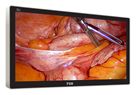 31" FSN Medical LCD 4K HD Display Monitor