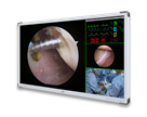55" 4K UHD Medical Grade Monitor (Built in Quad Multi-view)