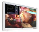 55" FSN Medical LCD Display Monitor
